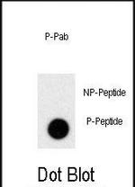 Phospho-Prolactin (Ser163) Antibody in Dot Blot (DB)