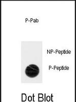 Phospho-ACK1 (Tyr518) Antibody in Dot Blot (DB)