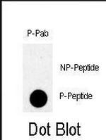 Phospho-TBK1 (Ser172) Antibody in Dot Blot (DB)