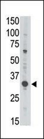 MAGEA3 Antibody in Western Blot (WB)