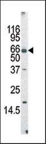 AF9 Antibody in Western Blot (WB)