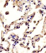 MMP12 Antibody in Immunohistochemistry (Paraffin) (IHC (P))