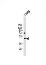 MMP12 Antibody in Western Blot (WB)