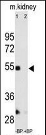 MMP12 Antibody in Western Blot (WB)