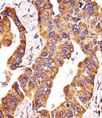 MMP14 Antibody in Immunohistochemistry (Paraffin) (IHC (P))