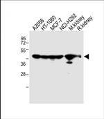 MMP14 Antibody in Western Blot (WB)