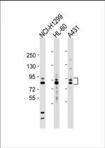 MMP9 Antibody in Western Blot (WB)