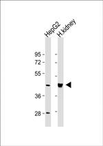 OAS1 Antibody in Western Blot (WB)