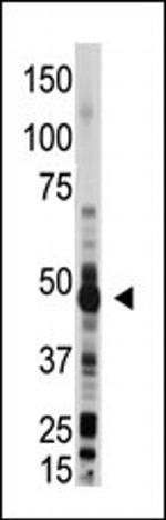 OAS1 Antibody in Western Blot (WB)