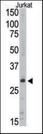 SIRT5 Antibody in Western Blot (WB)