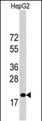 p27 Kip1 Antibody in Western Blot (WB)