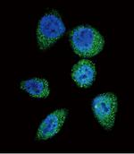 mTOR Antibody in Immunocytochemistry (ICC/IF)