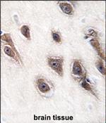 GRB2 Antibody in Immunohistochemistry (Paraffin) (IHC (P))