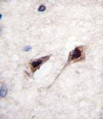 MEF2C Antibody in Immunohistochemistry (Paraffin) (IHC (P))