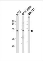 MEF2C Antibody in Western Blot (WB)