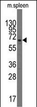 PARP3 Antibody in Western Blot (WB)