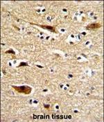 Amyloid Precursor Protein Antibody in Immunohistochemistry (Paraffin) (IHC (P))