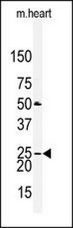 Claudin 2 Antibody in Western Blot (WB)