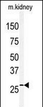 Claudin 2 Antibody in Western Blot (WB)