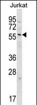 Glypican 3 Antibody in Western Blot (WB)