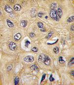 TSC2 Antibody in Immunohistochemistry (Paraffin) (IHC (P))