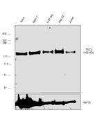 TSC2 Antibody in Western Blot (WB)