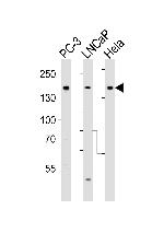 TSC2 Antibody in Western Blot (WB)