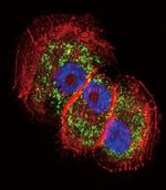 Parkin Antibody in Immunocytochemistry (ICC/IF)