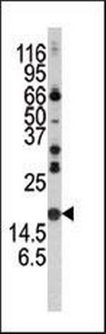 alpha Synuclein Antibody in Western Blot (WB)