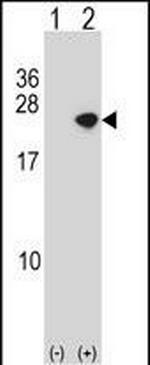 alpha Synuclein Antibody in Western Blot (WB)