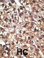 PINK1 Antibody in Immunohistochemistry (Paraffin) (IHC (P))