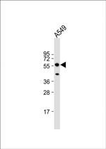 PINK1 Antibody in Western Blot (WB)