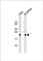 DJ-1 Antibody in Western Blot (WB)