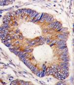 FXN Antibody in Immunohistochemistry (Paraffin) (IHC (P))