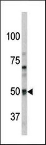 GPR37 Antibody in Western Blot (WB)