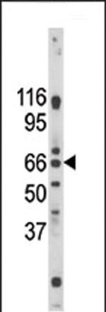 GPR37 Antibody in Western Blot (WB)