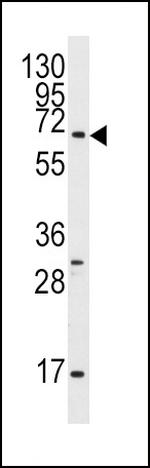 GPR37 Antibody in Western Blot (WB)