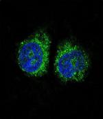 Nurr1 Antibody in Immunocytochemistry (ICC/IF)