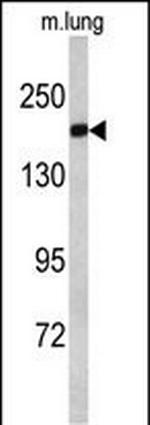 Alsin Antibody in Western Blot (WB)