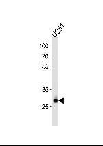 CNOT8 Antibody in Western Blot (WB)