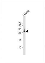 ELOVL6 Antibody in Western Blot (WB)