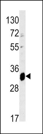 ELOVL6 Antibody in Western Blot (WB)