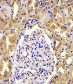 VHL Antibody in Immunohistochemistry (Paraffin) (IHC (P))