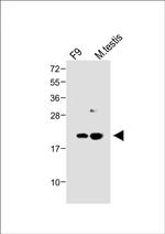 VHL Antibody in Western Blot (WB)