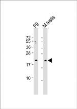 VHL Antibody in Western Blot (WB)