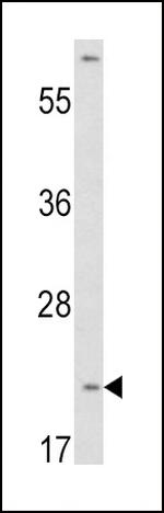 VHL Antibody in Western Blot (WB)