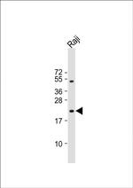 VHL Antibody in Western Blot (WB)