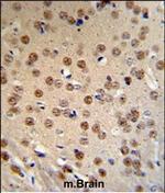 AMER1 Antibody in Immunohistochemistry (Paraffin) (IHC (P))