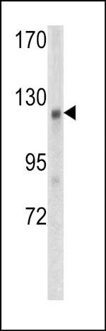 AMER1 Antibody in Western Blot (WB)