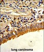 Osteopontin Antibody in Immunohistochemistry (Paraffin) (IHC (P))